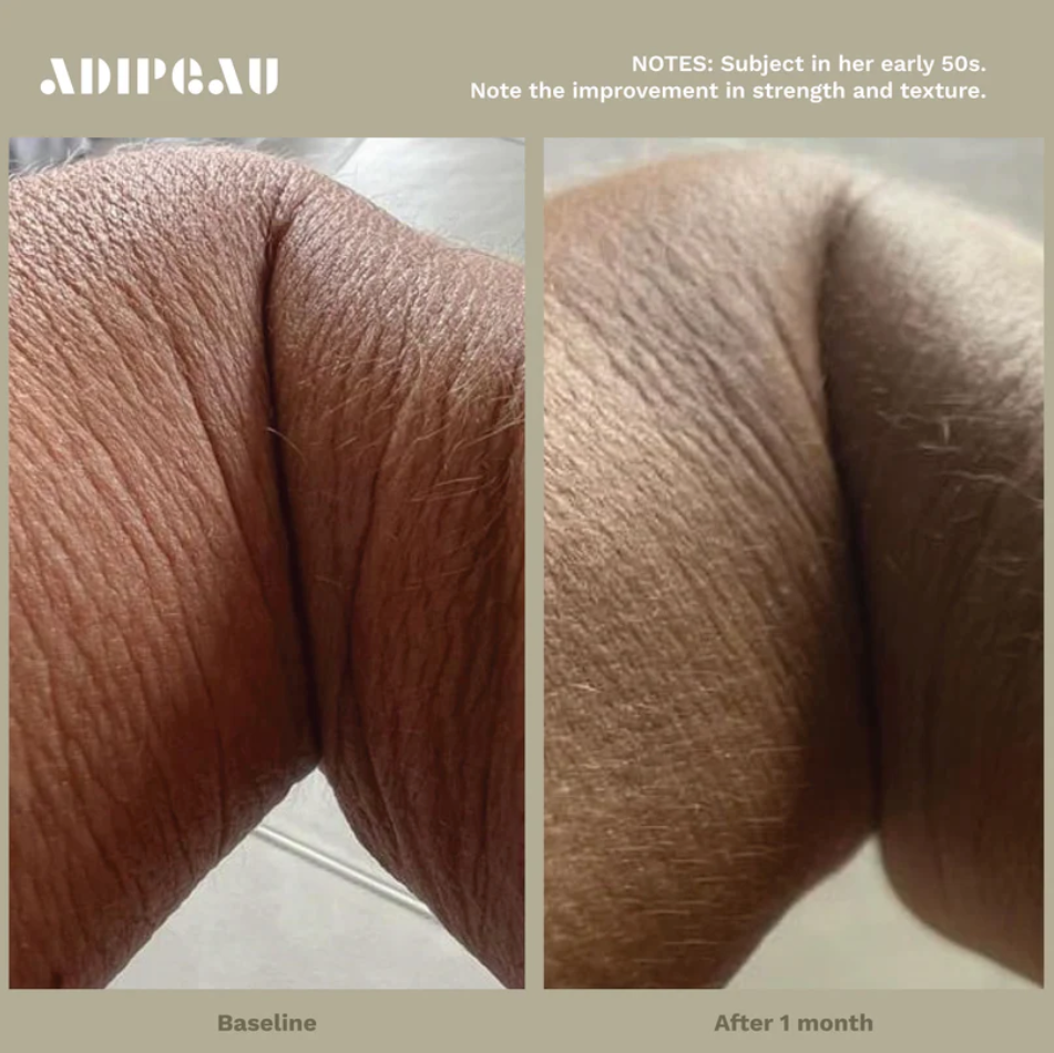 Adipeau Strength Gel