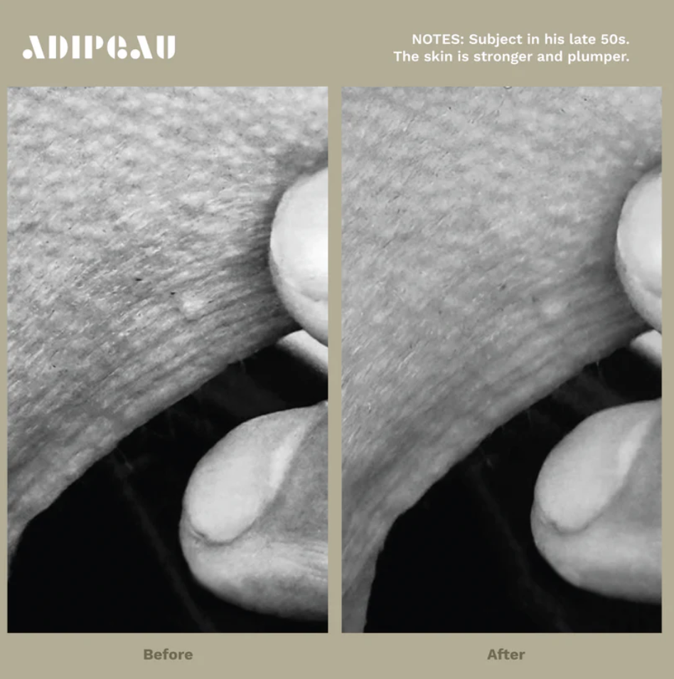 Adipeau Strength Gel