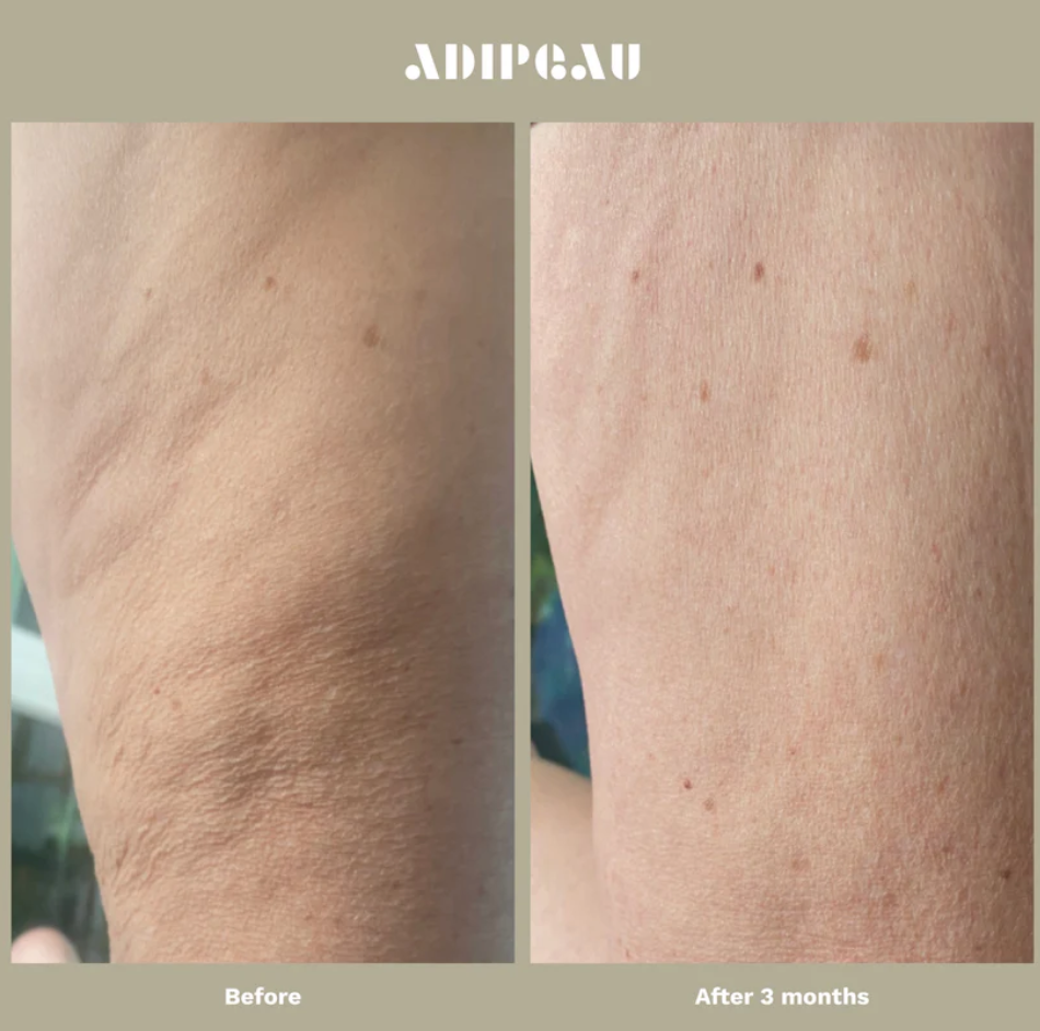 Adipeau Strength Gel