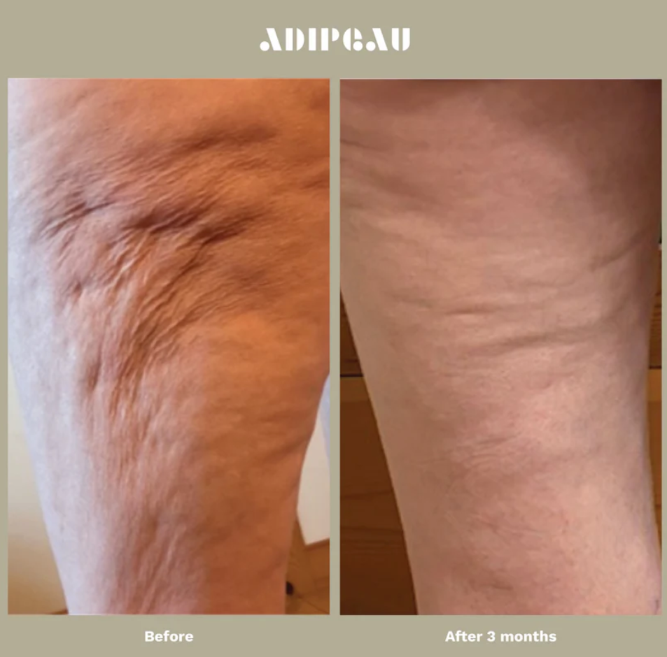 Adipeau Strength Gel
