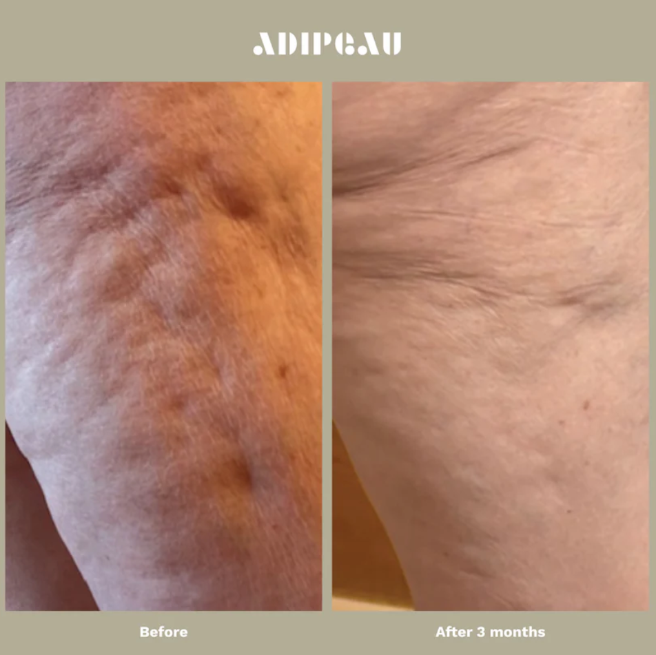 Adipeau Strength Gel