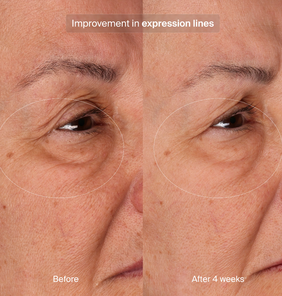 Pavise Bioadaptive Stess Repair