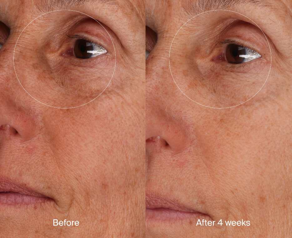 Pavise Bioadaptive Stess Repair