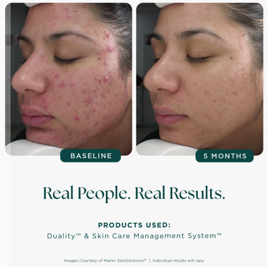 Marini Skin Solutions Age Intervention Duality