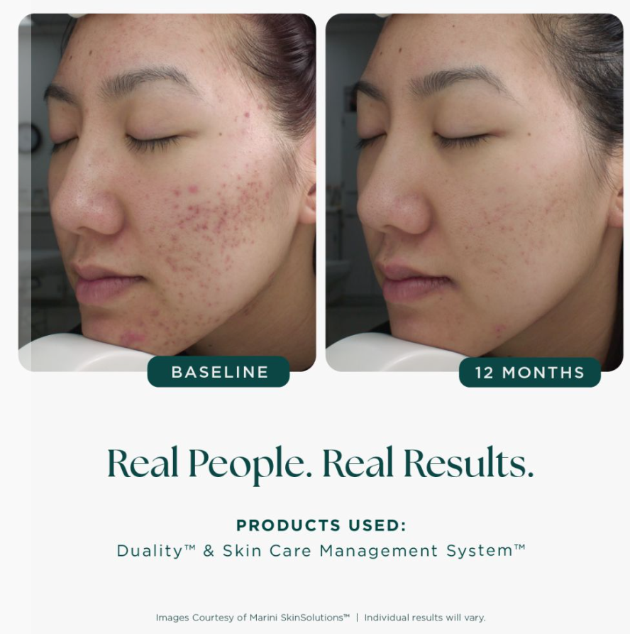 Marini Skin Solutions Age Intervention Duality