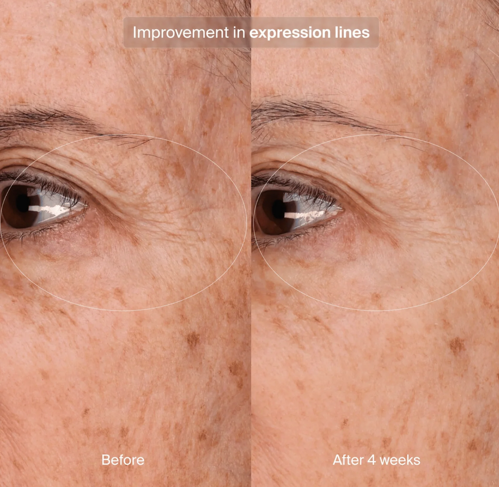 Pavise Precision Eye Lift